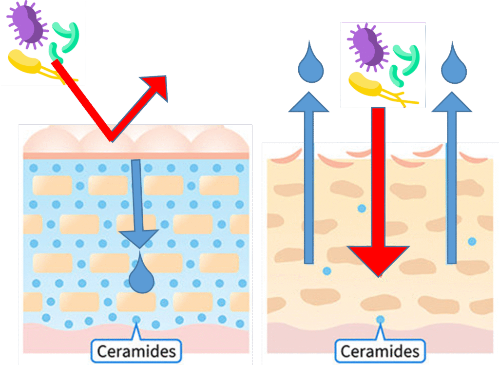 Bromelain and Ceramides in Pineapple 1 ceramides-pineapple